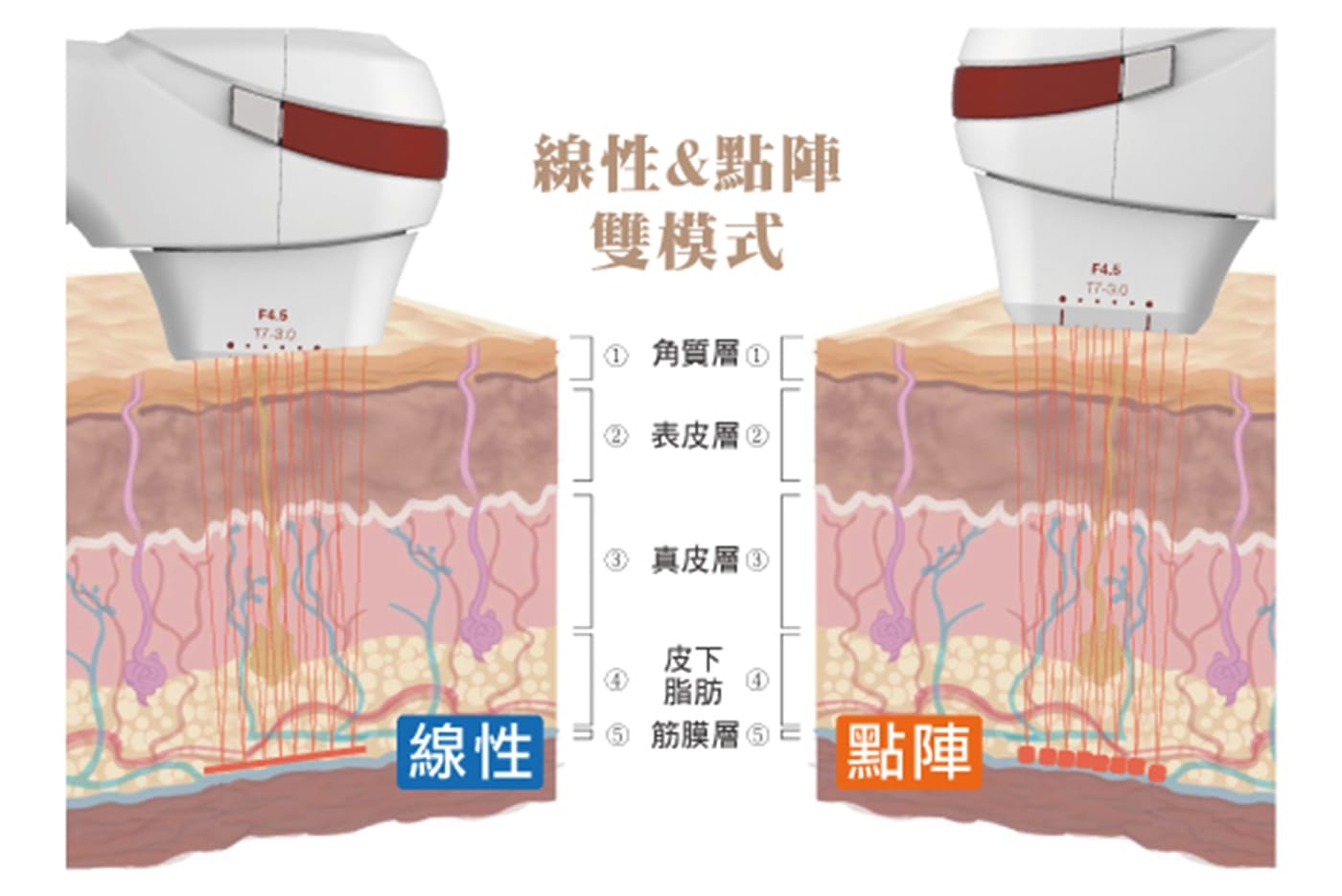 線性與點陣雙模式示意圖