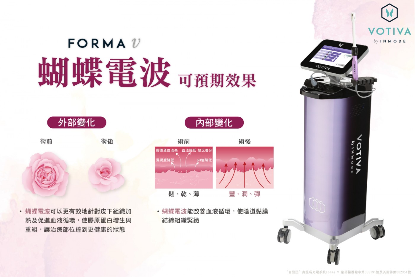 蝴蝶電波的治療效果​